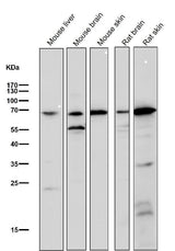Anti-Choline Acetyltransferase Rabbit Monoclonal Antibody Boster Bio