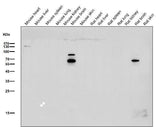 Anti-CHAT/Choline Acetyltransferase Rabbit Monoclonal Antibody Boster Bio