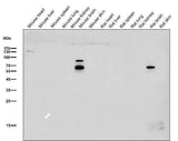 Anti-CHAT/Choline Acetyltransferase Rabbit Monoclonal Antibody Boster Bio