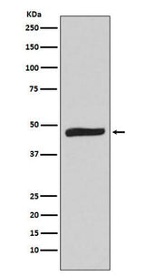 Anti-MAPKAP Kinase 2 Rabbit Monoclonal Antibody Boster Bio
