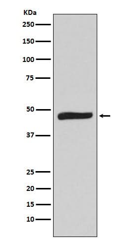 Anti-MAPKAP Kinase 2 Rabbit Monoclonal Antibody Boster Bio