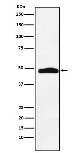 Anti-MAPKAP Kinase 2 Rabbit Monoclonal Antibody Boster Bio