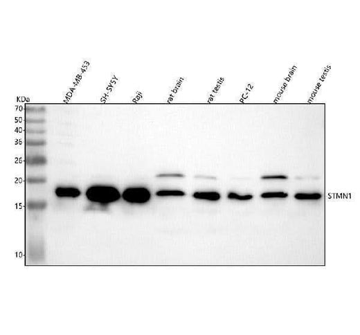 Anti-Stathmin 1 STMN1 Rabbit Monoclonal Antibody Boster Bio