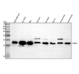 Anti-Stathmin 1 STMN1 Rabbit Monoclonal Antibody Boster Bio