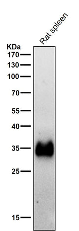 Anti-HLA-DRA/Hla Dr Rabbit Monoclonal Antibody Boster Bio