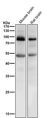 Anti-Prolactin Receptor Rabbit Monoclonal Antibody Boster Bio