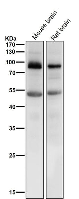 Anti-Prolactin Receptor Rabbit Monoclonal Antibody Boster Bio