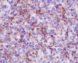 Anti-VCAM1/Cd106 Rabbit Monoclonal Antibody Boster Bio