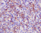 Anti-VCAM1/Cd106 Rabbit Monoclonal Antibody Boster Bio
