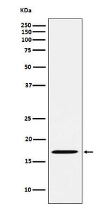 Anti-FHIT Rabbit Monoclonal Antibody Boster Bio
