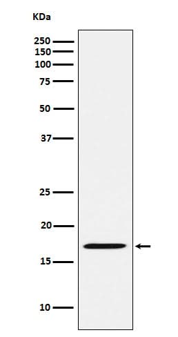 Anti-FHIT Rabbit Monoclonal Antibody Boster Bio