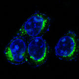 Anti-CD9 Rabbit Monoclonal Antibody Boster Bio