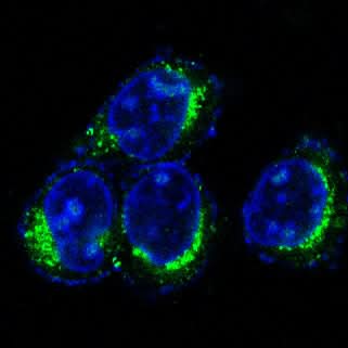 Anti-CD9 Rabbit Monoclonal Antibody Boster Bio