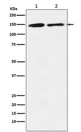 Anti-mSin3A Rabbit Monoclonal Antibody Boster Bio