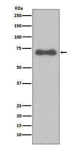 Anti-NUMB Rabbit Monoclonal Antibody Boster Bio
