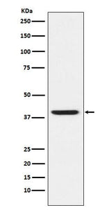 Anti-RING2 / RING1B / RNF2 Rabbit Monoclonal Antibody Boster Bio