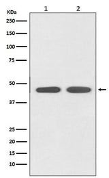 Anti-AGTR1 Rabbit Monoclonal Antibody Boster Bio