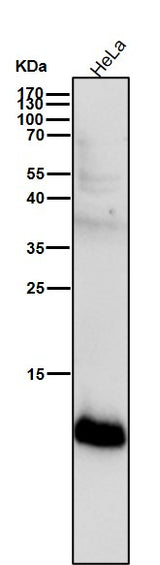 Anti-S100A4 Rabbit Monoclonal Antibody Boster Bio