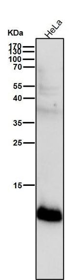 Anti-S100A4 Rabbit Monoclonal Antibody Boster Bio