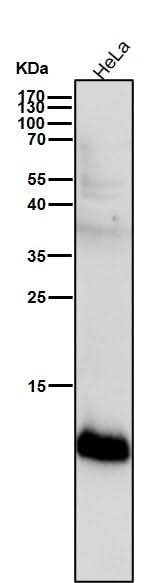 Anti-S100A4 Rabbit Monoclonal Antibody Boster Bio