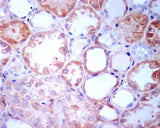 Anti-TGFBI/Beta Ig H3 Rabbit Monoclonal Antibody Boster Bio