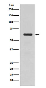 Anti-TGFBI/Beta Ig H3 Rabbit Monoclonal Antibody Boster Bio