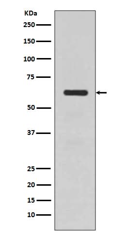Anti-TGFBI/Beta Ig H3 Rabbit Monoclonal Antibody Boster Bio
