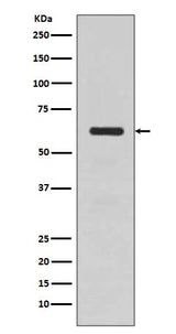 Anti-TGFBI/Beta Ig H3 Rabbit Monoclonal Antibody Boster Bio