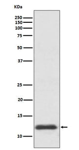 Anti-TRX1 TXN Rabbit Monoclonal Antibody Boster Bio