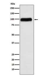 Anti-SERPING1 Rabbit Monoclonal Antibody Boster Bio