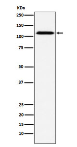 Anti-CD30 Rabbit Monoclonal Antibody Boster Bio