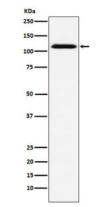 Anti-CD30 Rabbit Monoclonal Antibody Boster Bio