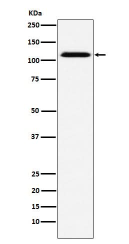 Anti-CD30 Rabbit Monoclonal Antibody Boster Bio