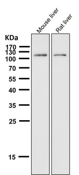 Anti-ABCG1 Rabbit Monoclonal Antibody Boster Bio