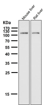 Anti-ABCG1 Rabbit Monoclonal Antibody Boster Bio