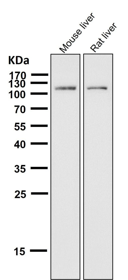Anti-ABCG1 Rabbit Monoclonal Antibody Boster Bio