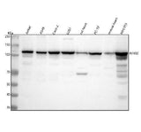 Anti-NFkB p100 / p52 Rabbit Monoclonal Antibody Boster Bio