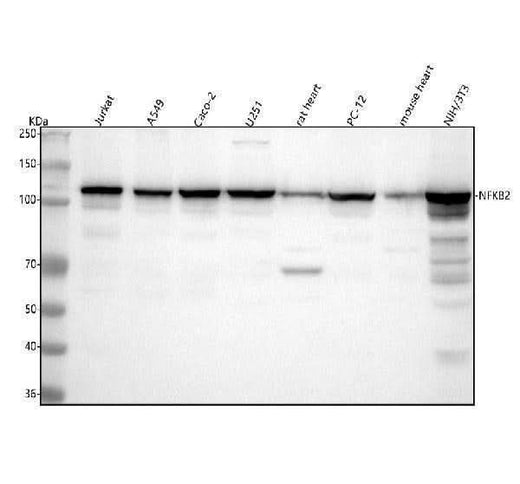 Anti-NFkB p100 / p52 Rabbit Monoclonal Antibody Boster Bio