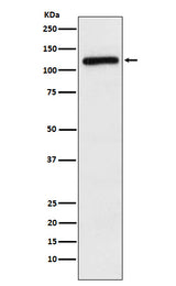 Anti-APLP2 Rabbit Monoclonal Antibody Boster Bio