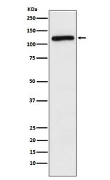 Anti-APLP2 Rabbit Monoclonal Antibody Boster Bio
