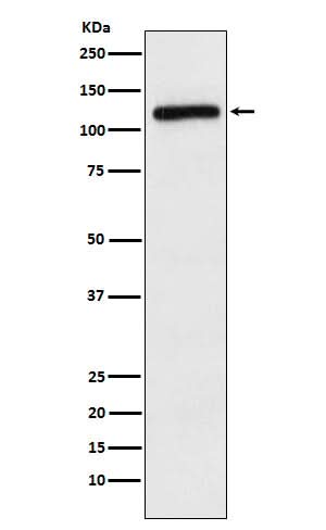 Anti-APLP2 Rabbit Monoclonal Antibody Boster Bio