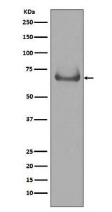 Anti-Lamin B Receptor LBR Rabbit Monoclonal Antibody Boster Bio