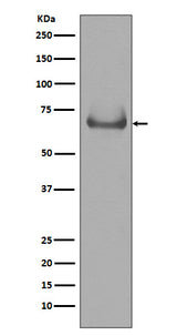 Anti-Lamin B Receptor LBR Rabbit Monoclonal Antibody Boster Bio