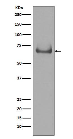 Anti-Lamin B Receptor LBR Rabbit Monoclonal Antibody Boster Bio
