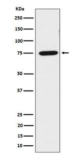 Anti-LPP Rabbit Monoclonal Antibody Boster Bio