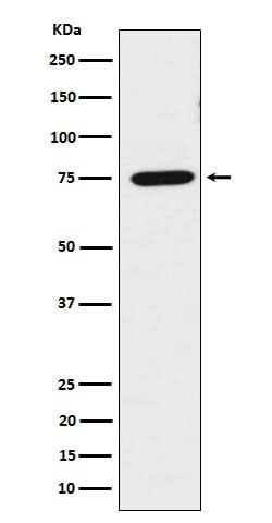 Anti-LPP Rabbit Monoclonal Antibody Boster Bio