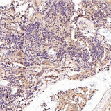 Anti-p57 Kip2 Rabbit Monoclonal Antibody Boster Bio