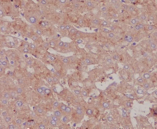 Anti-Albumin Rabbit Monoclonal Antibody Boster Bio