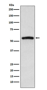 Anti-IRAK4 Monoclonal Antibody Boster Bio