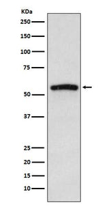 Anti-IRAK4 Monoclonal Antibody Boster Bio